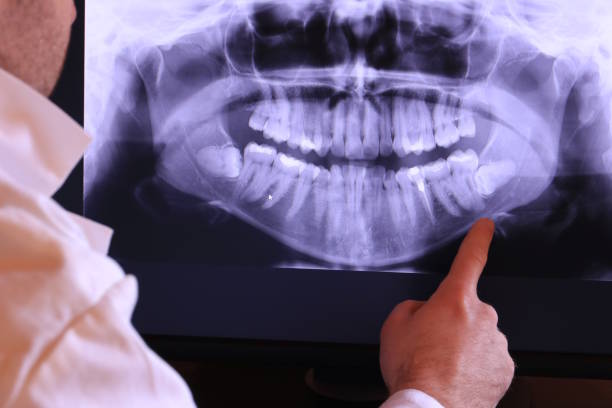 Best 24-Hour Emergency Dental Care in Pearl Beach, MI