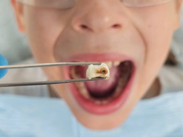 Best Emergency Dental Care for Sports Injuries in Pearl Beach, MI
